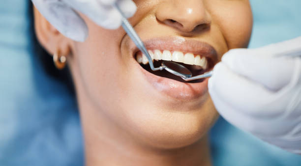 Best Emergency Wisdom Tooth Extraction in Clarksville, IN